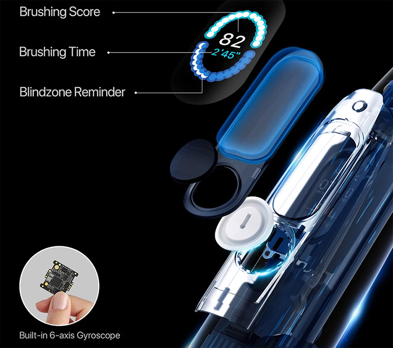 Xiaomi Oclean X Pro Elite fogkefe teszt – a csúcsok csúcsa! 7